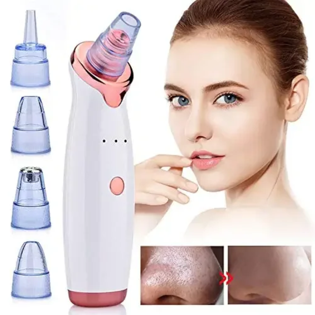 Deep Clean Pore Vacuum | 5 in 1 Blackhead Remover | Glowing Skin Tool
