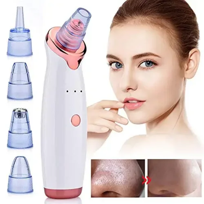 Deep Clean Pore Vacuum | 5 in 1 Blackhead Remover | Glowing Skin Tool